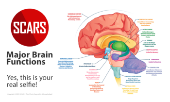 Major Brain Functions - SCARS Infographic