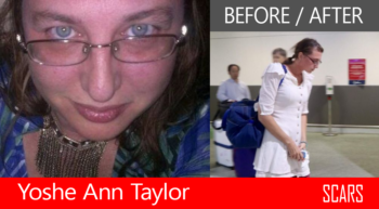 Yoshe Ann Taylor - Before And After The Cambodian Prison