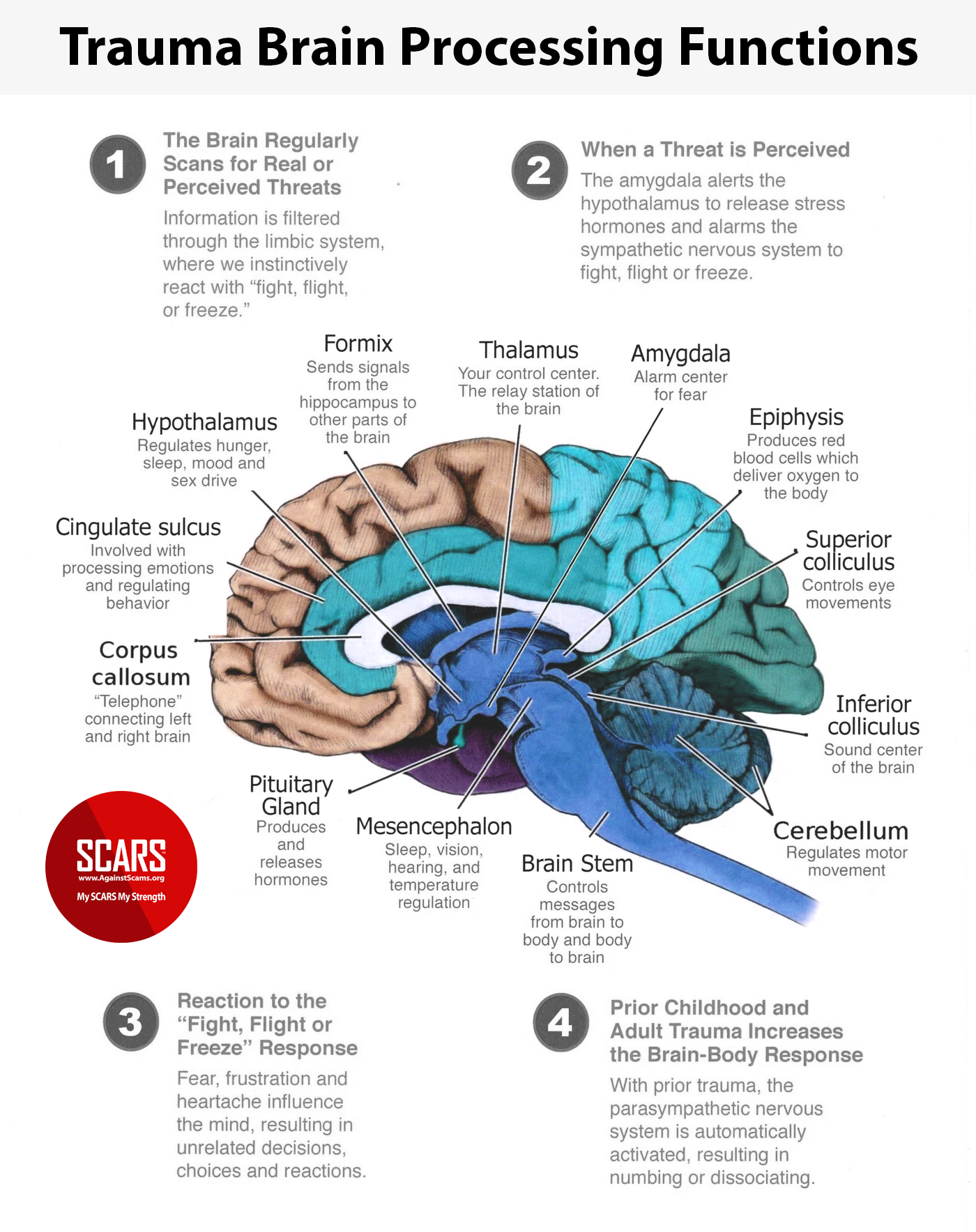 Trauma - Brain Processing Functions - Infographic 22